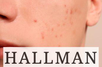 problemas-de-acne